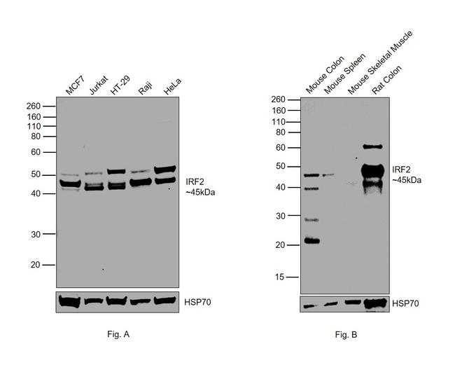 IRF2 Antibody in Western Blot (WB)