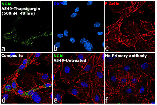 NGAL Antibody in Immunocytochemistry (ICC/IF)