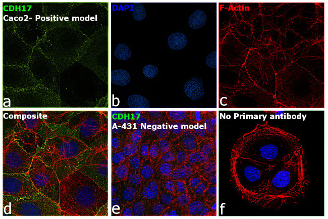 CDH17 Antibody