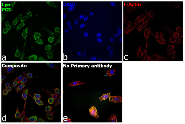 Lyn Antibody in Immunocytochemistry (ICC/IF)