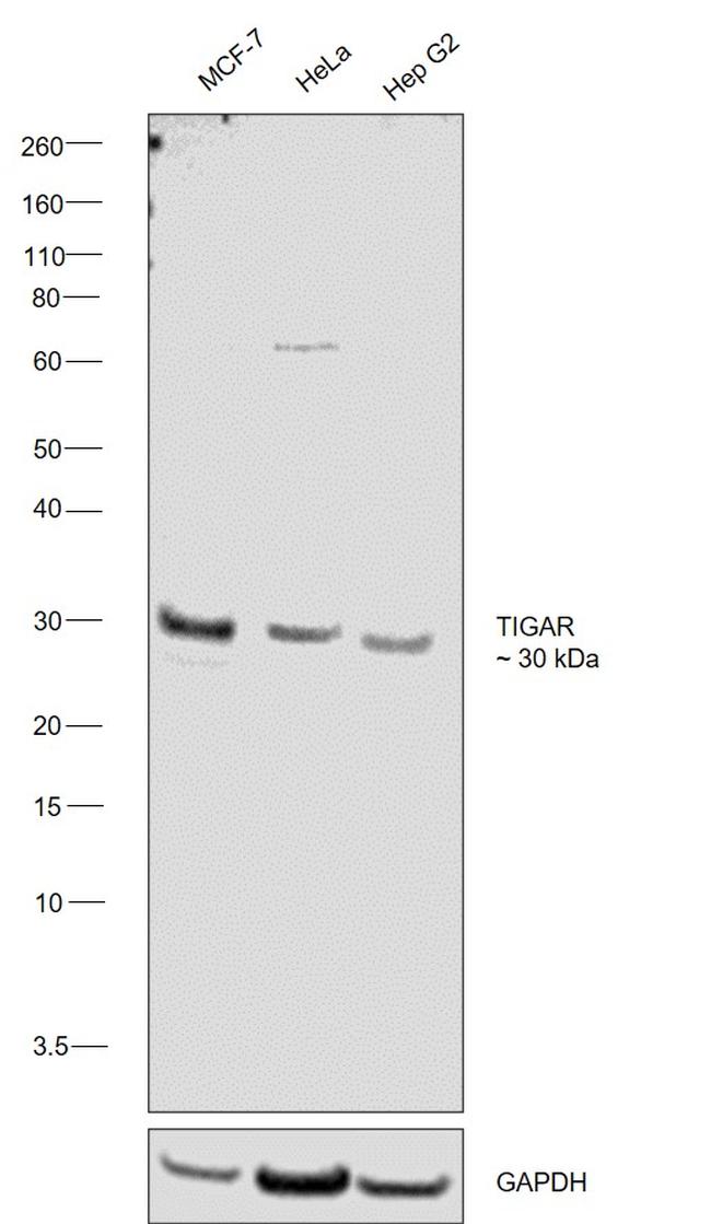 TIGAR Antibody in Western Blot (WB)