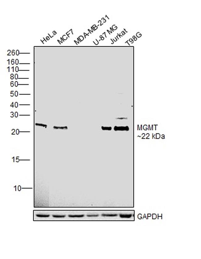 MGMT Antibody in Western Blot (WB)