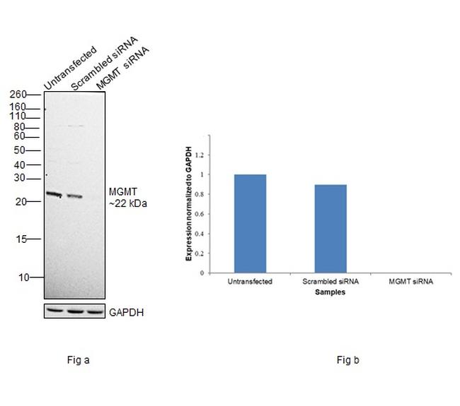 MGMT Antibody in Western Blot (WB)