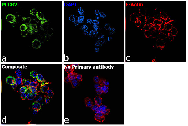 PLCG2 Antibody in Immunocytochemistry (ICC/IF)