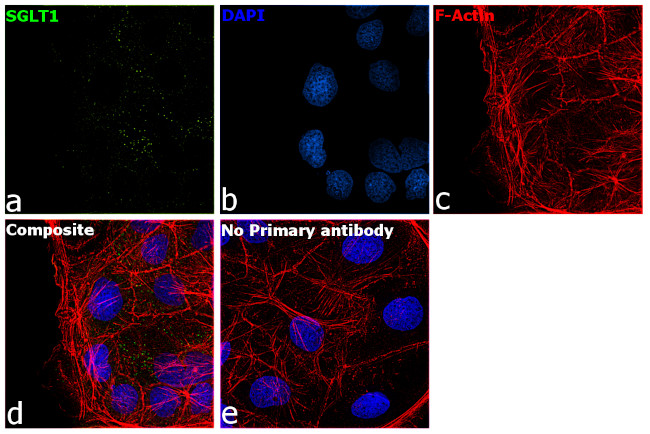 SGLT1 Antibody in Immunocytochemistry (ICC/IF)