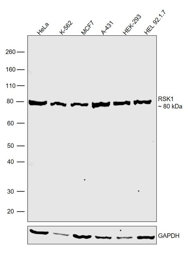 RSK1 Antibody in Western Blot (WB)