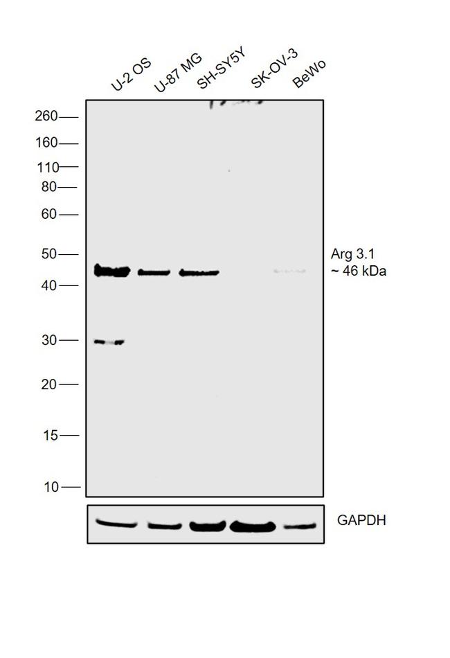 Arg3.1 Antibody in Western Blot (WB)