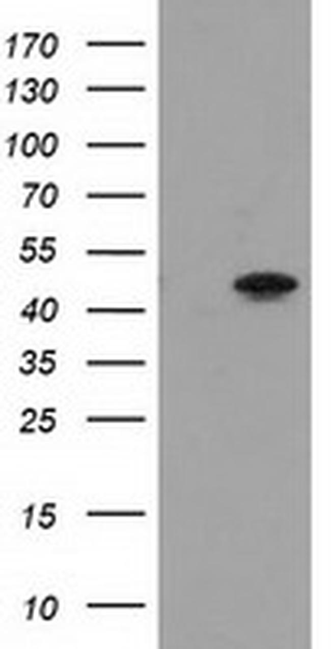 PACSIN3 Antibody in Western Blot (WB)