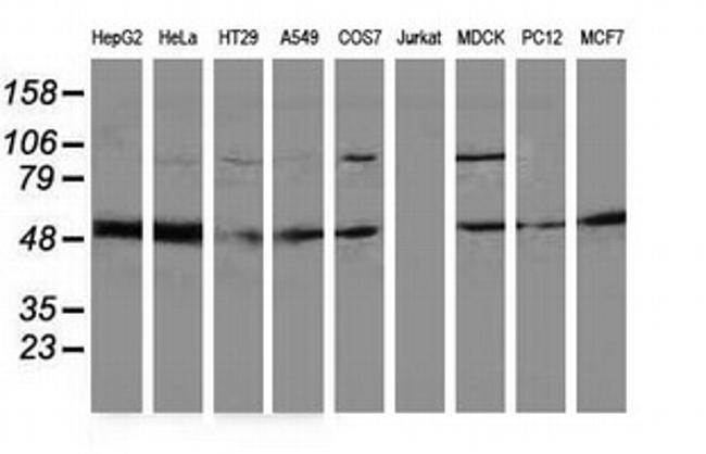 PACSIN3 Antibody in Western Blot (WB)