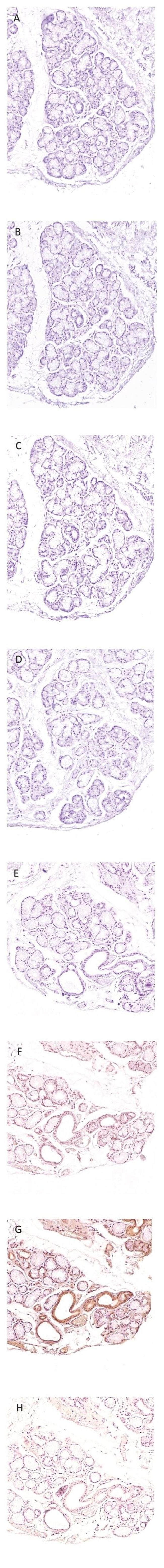 PADI2 Antibody in Immunohistochemistry (IHC)