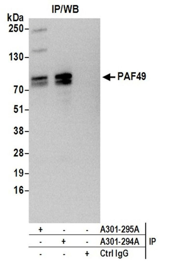 PAF49 Antibody in Immunoprecipitation (IP)