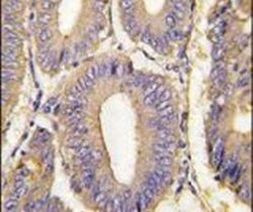 PAK1 Antibody in Immunohistochemistry (IHC)