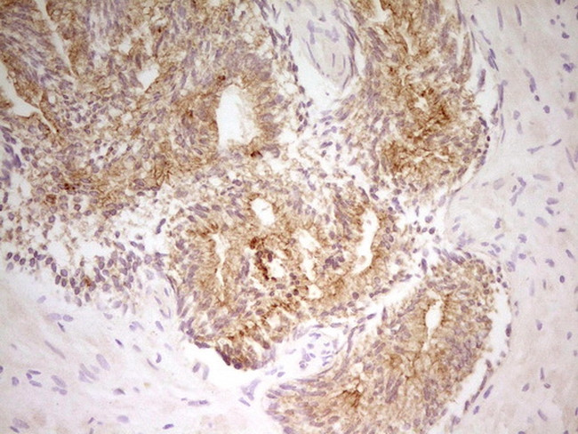 PAK4 Antibody in Immunohistochemistry (Paraffin) (IHC (P))