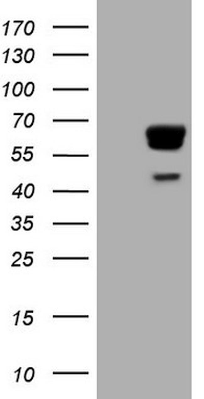 PAK4 Antibody in Western Blot (WB)