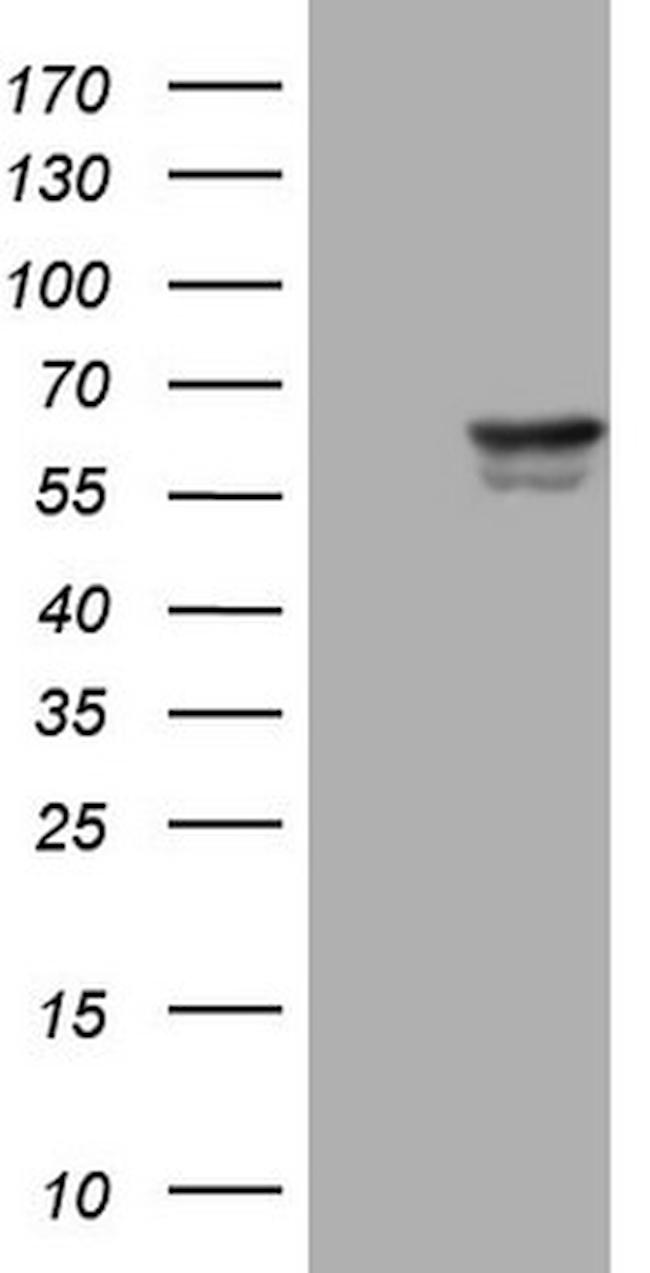 PAK4 Antibody in Western Blot (WB)