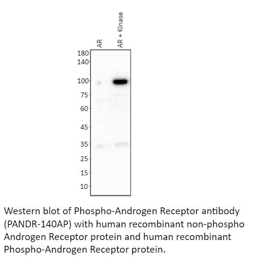 Phospho-Androgen Receptor (Ser568) Antibody in Western Blot (WB)