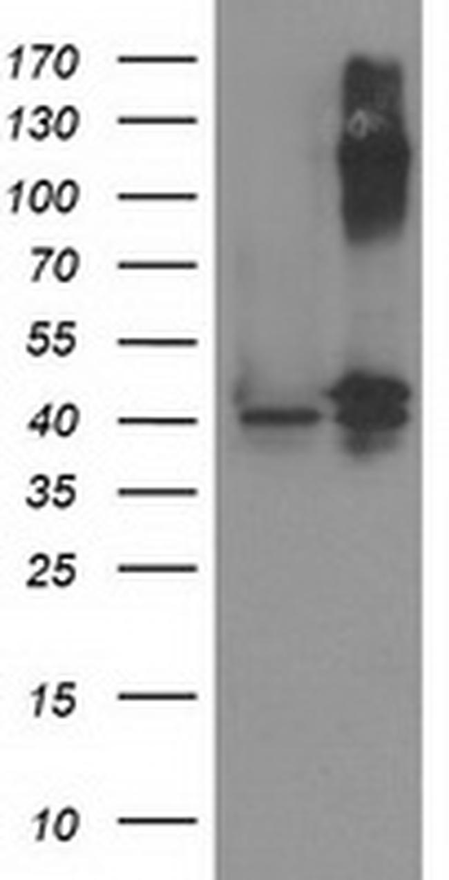 PANK3 Antibody in Western Blot (WB)