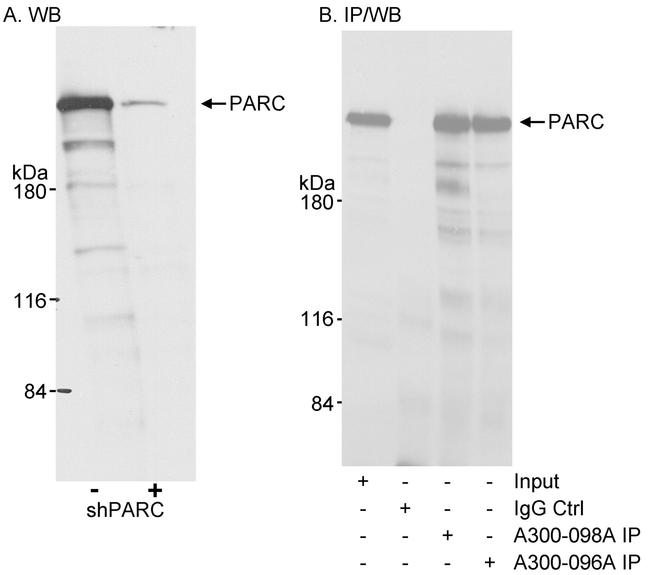 PARC/H7-AP1 Antibody in Western Blot (WB)