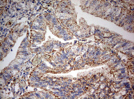 PARN Antibody in Immunohistochemistry (Paraffin) (IHC (P))