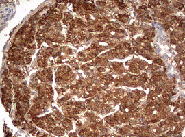 PARN Antibody in Immunohistochemistry (Paraffin) (IHC (P))