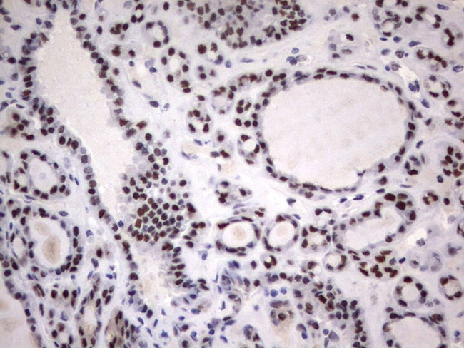 PARN Antibody in Immunohistochemistry (Paraffin) (IHC (P))