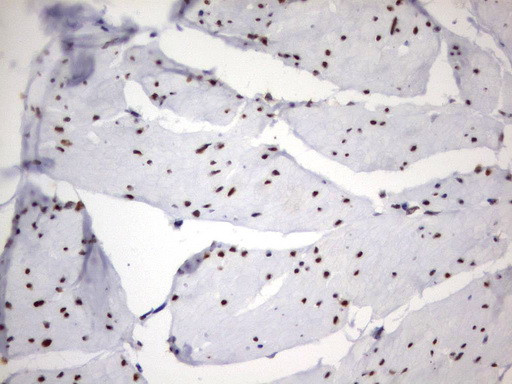 PARN Antibody in Immunohistochemistry (Paraffin) (IHC (P))