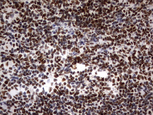 PARN Antibody in Immunohistochemistry (Paraffin) (IHC (P))