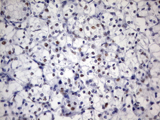 PARN Antibody in Immunohistochemistry (Paraffin) (IHC (P))