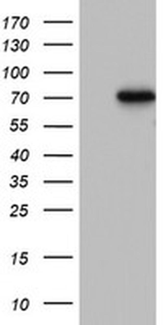 PARN Antibody in Western Blot (WB)