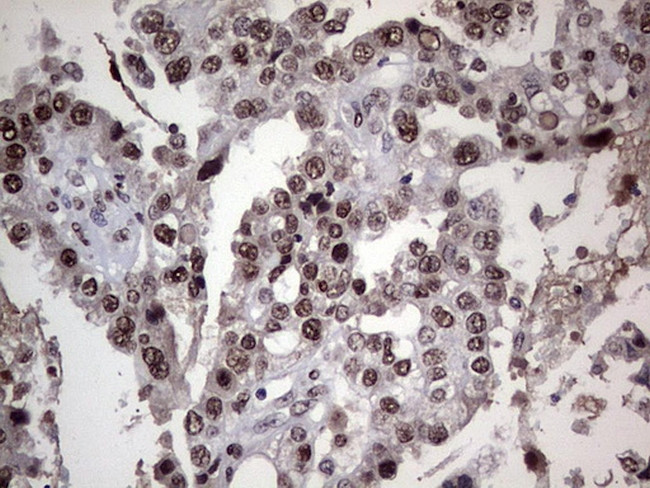 PARP1 Antibody in Immunohistochemistry (Paraffin) (IHC (P))