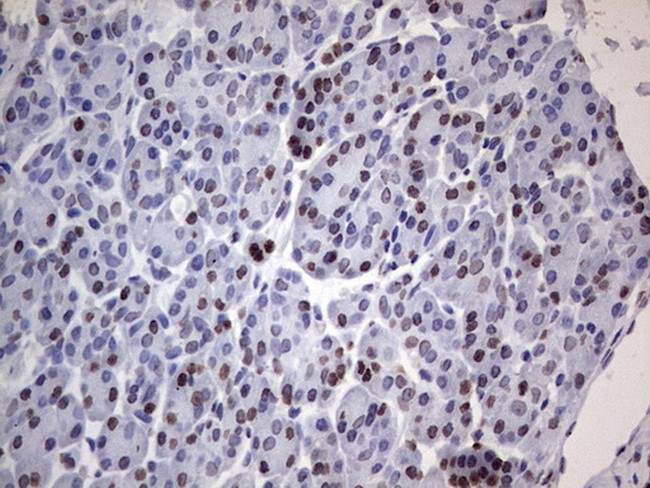 PARP1 Antibody in Immunohistochemistry (Paraffin) (IHC (P))