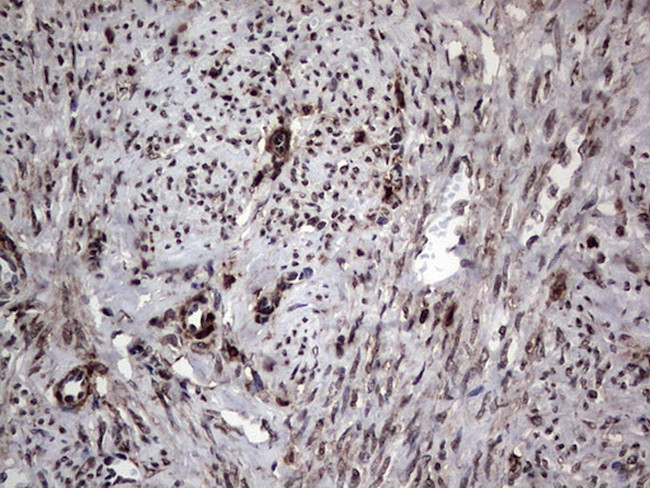 PARP1 Antibody in Immunohistochemistry (Paraffin) (IHC (P))