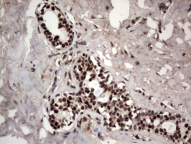 PARP1 Antibody in Immunohistochemistry (Paraffin) (IHC (P))