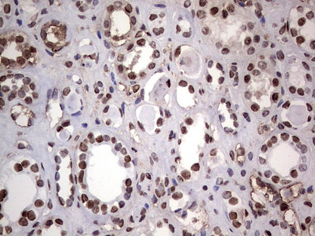 PARP1 Antibody in Immunohistochemistry (Paraffin) (IHC (P))