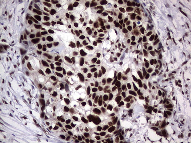 PARP1 Antibody in Immunohistochemistry (Paraffin) (IHC (P))