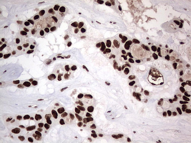 PARP1 Antibody in Immunohistochemistry (Paraffin) (IHC (P))