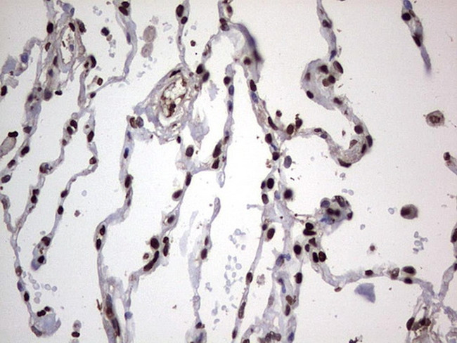 PARP1 Antibody in Immunohistochemistry (Paraffin) (IHC (P))