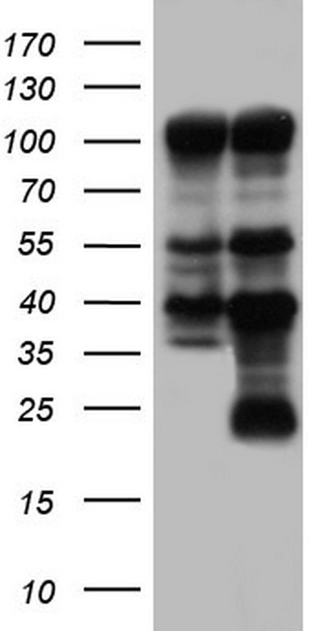 PARP1 Antibody in Western Blot (WB)