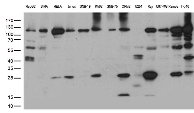 PARP1 Antibody in Western Blot (WB)