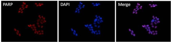 PARP1 Antibody in Immunocytochemistry (ICC/IF)