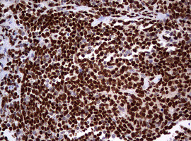 PAX5 Antibody in Immunohistochemistry (Paraffin) (IHC (P))