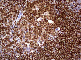 PAX5 Antibody in Immunohistochemistry (Paraffin) (IHC (P))