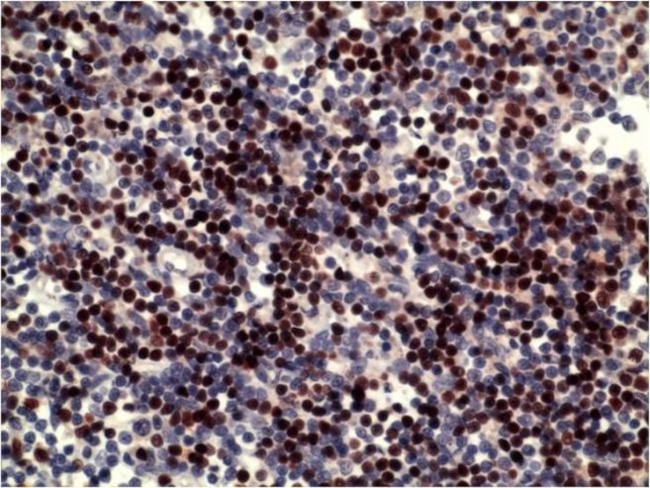 PAX5 Antibody in Immunohistochemistry (Paraffin) (IHC (P))