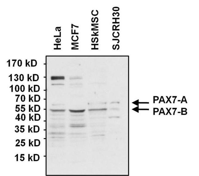 PAX7 Antibody in Western Blot (WB)