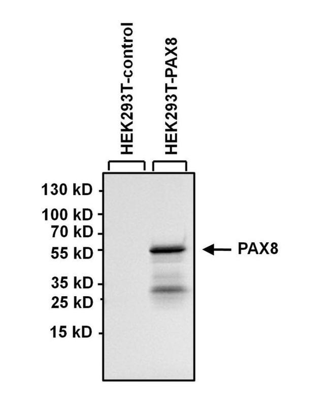 PAX8 Monoclonal Antibody (1F8-3A8) (MA1-117)