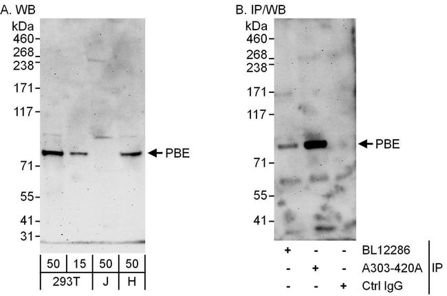 PBE Antibody in Western Blot (WB)