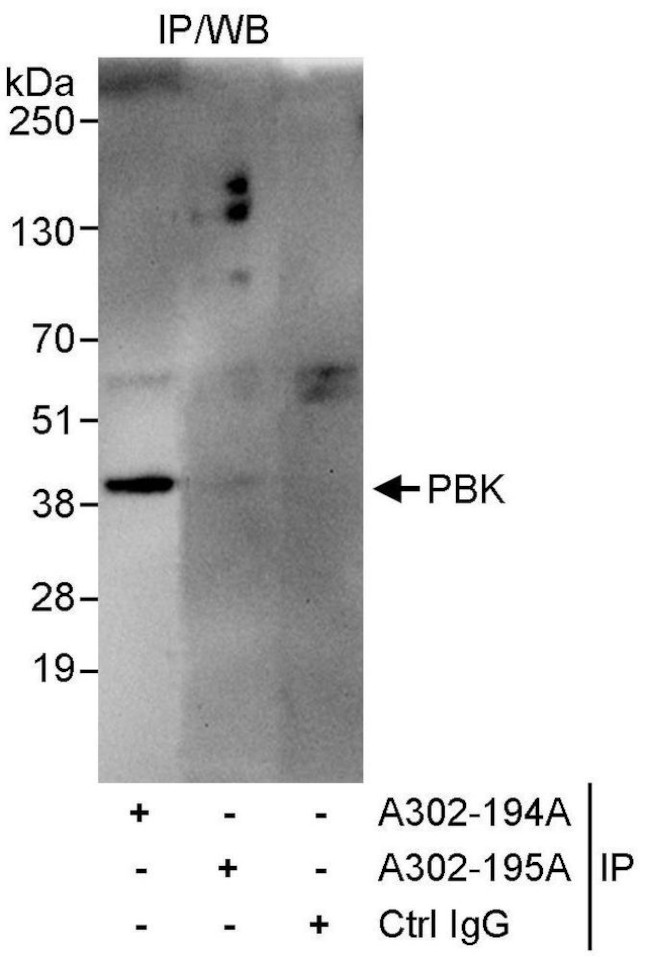 PBK Antibody in Immunoprecipitation (IP)