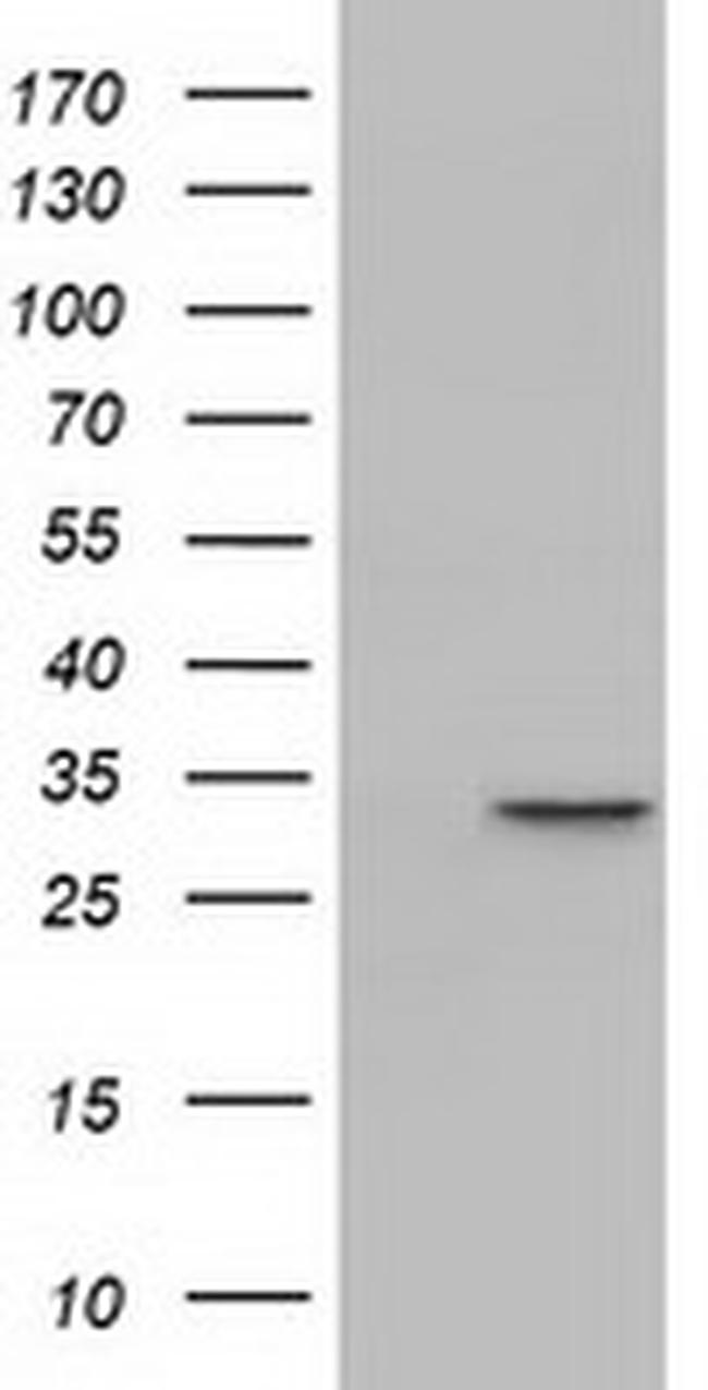 PBLD Antibody in Western Blot (WB)