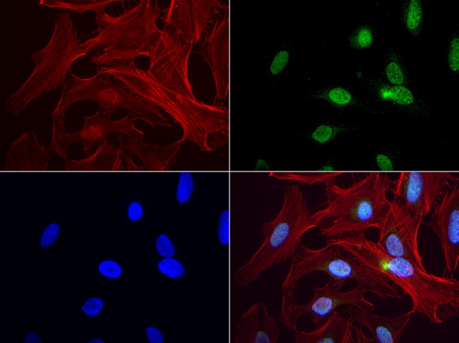 PBX1 Antibody in Immunocytochemistry (ICC/IF)