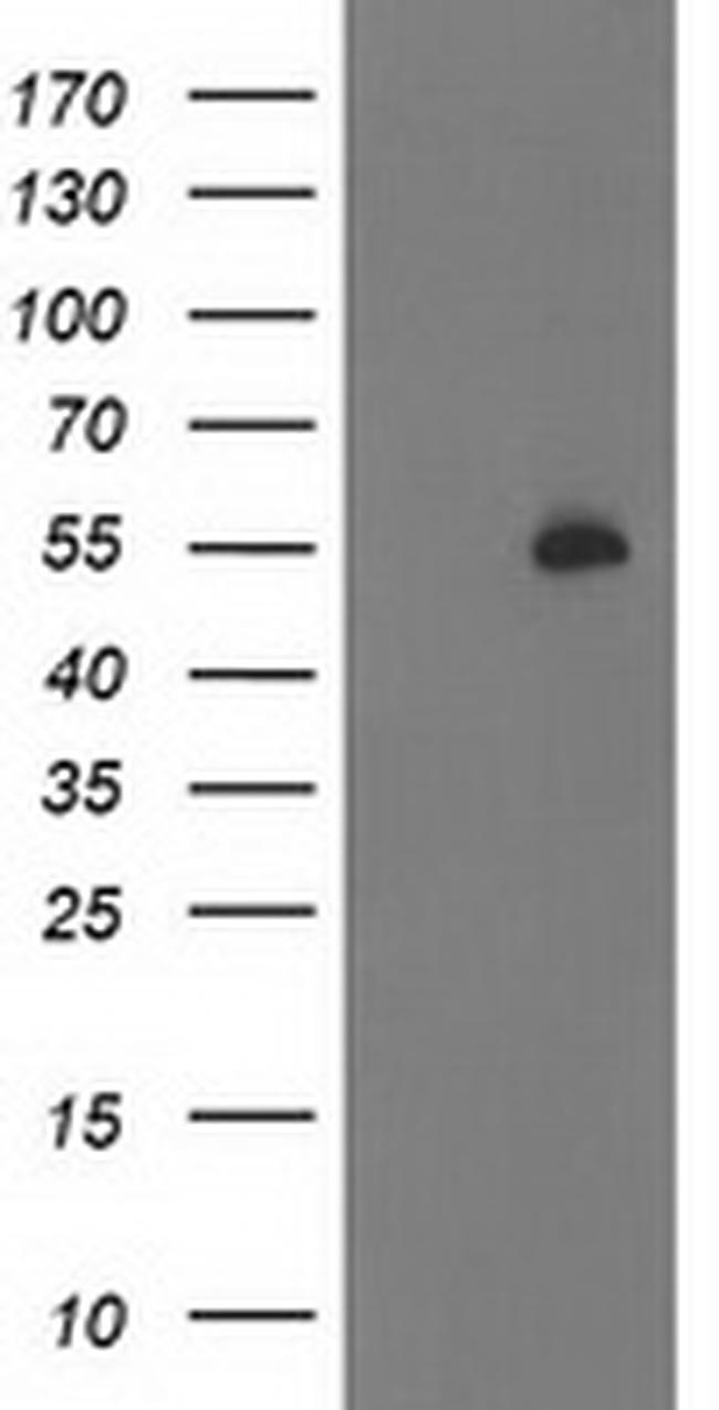 PBX1 Antibody in Western Blot (WB)